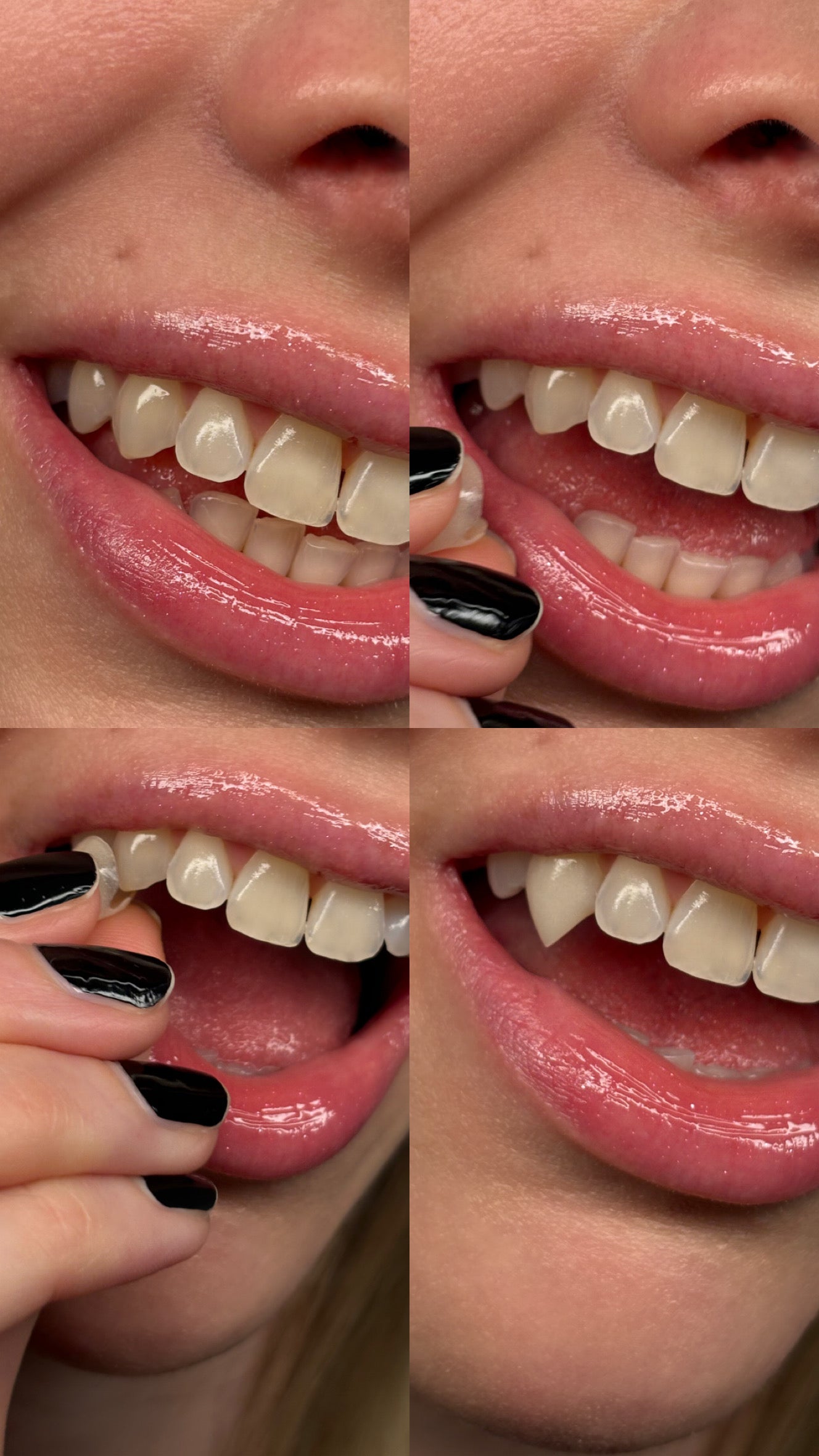 Vampire Grillz Fangs